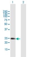 Merck ANTI-WISP2