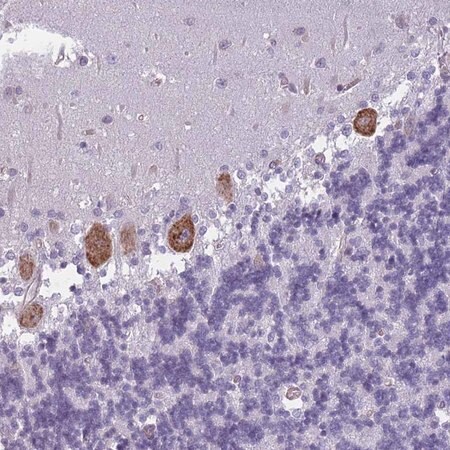 Merck Anti-OR6B2 antibody produced in rabbit