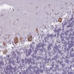 Merck Anti-OR6B2 antibody produced in rabbit