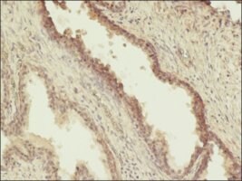 Merck MONOCLONAL ANTI-PHOSPHOTHREONINE, CLONE&