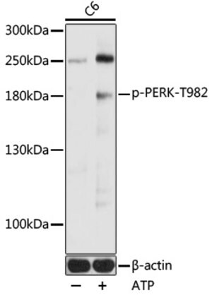 Merck ANTI-PHOSPHO-PERK-T982 ANTIBODY PRODUCE&