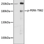 Merck ANTI-PHOSPHO-PERK-T982 ANTIBODY PRODUCE&