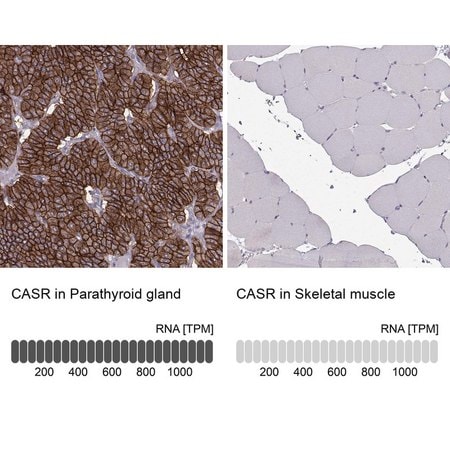 Merck Anti-CASR antibody produced in rabbit