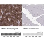 Merck Anti-CASR antibody produced in rabbit