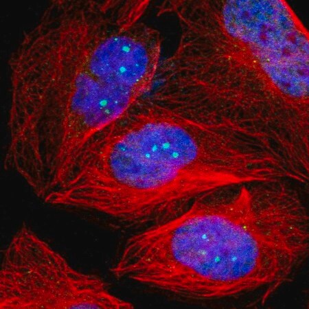 Merck Anti-TP53BP1 antibody produced in rabbit