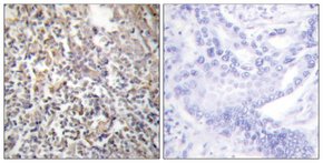 Merck ANTI-FIBRONECTIN 1 ANTIBODY PROD IN