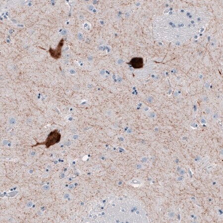 Merck Anti-CHAT antibody produced in rabbit