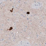 Merck Anti-CHAT antibody produced in rabbit