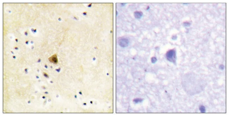 Merck Anti-RYR2 antibody produced in rabbit