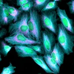 Thermo Fisher Scientific Goat anti-Rabbit IgG (H+L) Highly Cross-Adsorbed Secondary Antibody, Alexa Fluor Plus 405