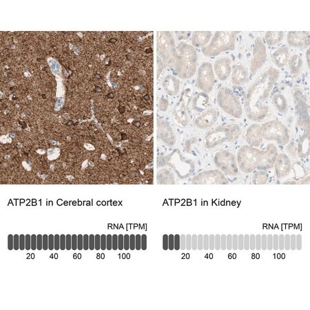 Merck Anti-ATP2B1 antibody produced in rabbit
