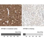 Merck Anti-ATP2B1 antibody produced in rabbit