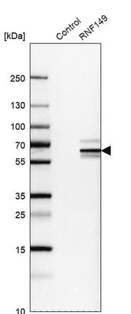 Merck Anti-RNF149 antibody produced in rabbit