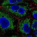 Merck ANTI-HUMAN IGM (MU CHAIN), CF647