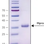 Merck Mpro, 3CL Protease from coronavirus SARS