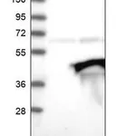 Merck ANTI-UBXN8