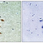 Merck Anti-TOP2A, antibody produced in rabbit