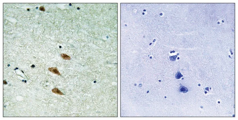 Merck Anti-TOP2A, antibody produced in rabbit