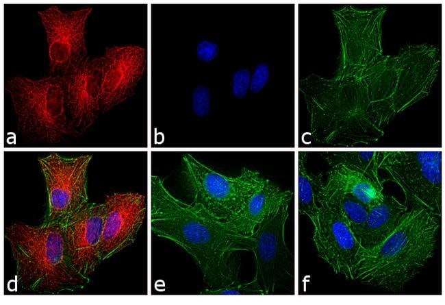 Thermo Fisher Scientific Chicken anti-Rat IgG (H+L) Secondary Antibody, TRITC