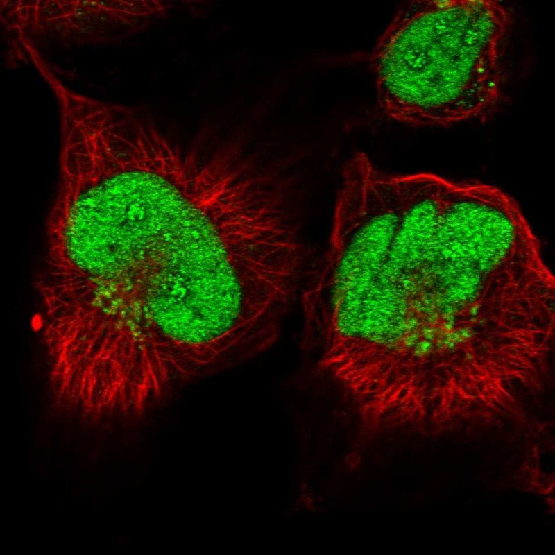 Atlas Antibodies Anti-ANKRD49 Antibody