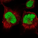 Atlas Antibodies Anti-ANKRD49 Antibody