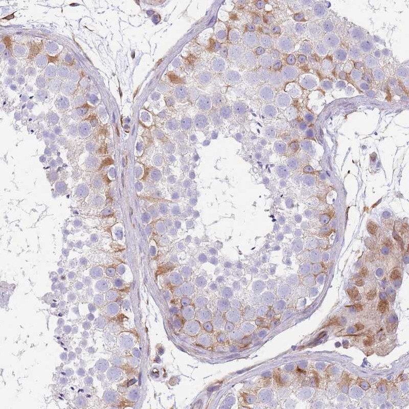Atlas Antibodies Anti-ANKRD53 Antibody