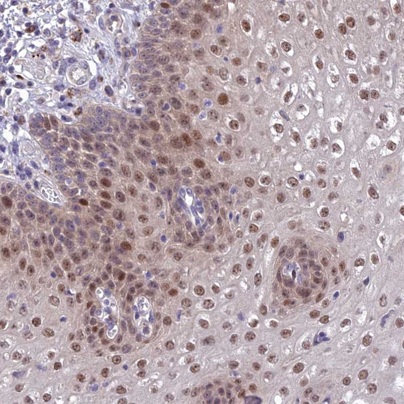 Atlas Antibodies Anti-ANKRD52 Antibody