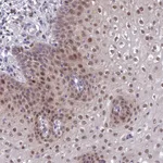 Atlas Antibodies Anti-ANKRD52 Antibody
