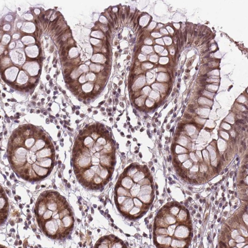 Atlas Antibodies Anti-ANKRD54 Antibody