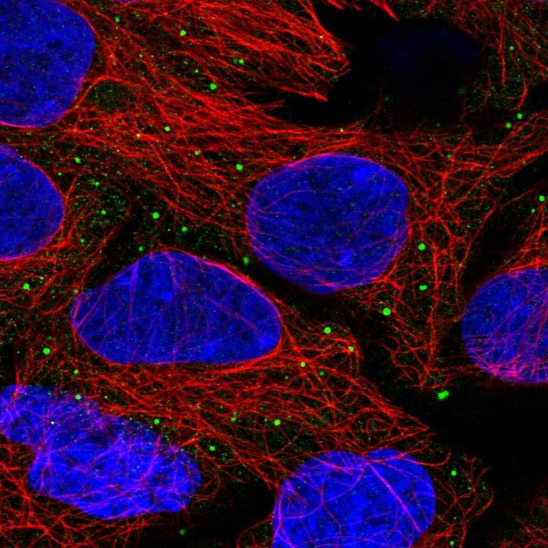 Atlas Antibodies Anti-ANKRD6 Antibody