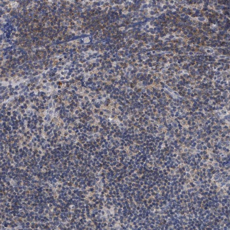 Atlas Antibodies Anti-ANKRD55 Antibody