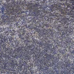 Atlas Antibodies Anti-ANKRD55 Antibody