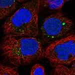 Atlas Antibodies Anti-ANKRD6 Antibody