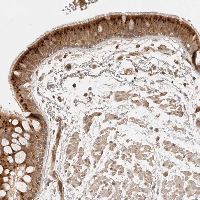 Atlas Antibodies Anti-ANKRD61 Antibody
