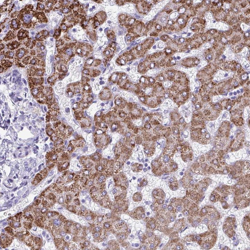 Atlas Antibodies Anti-ANKRD60 Antibody