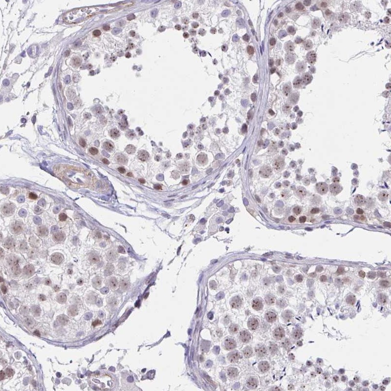 Atlas Antibodies Anti-ANKRD62 Antibody