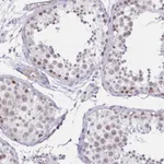 Atlas Antibodies Anti-ANKRD62 Antibody