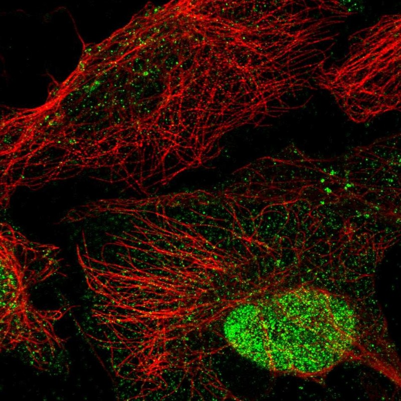 Atlas Antibodies Anti-ANKRD7 Antibody