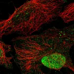 Atlas Antibodies Anti-ANKRD7 Antibody