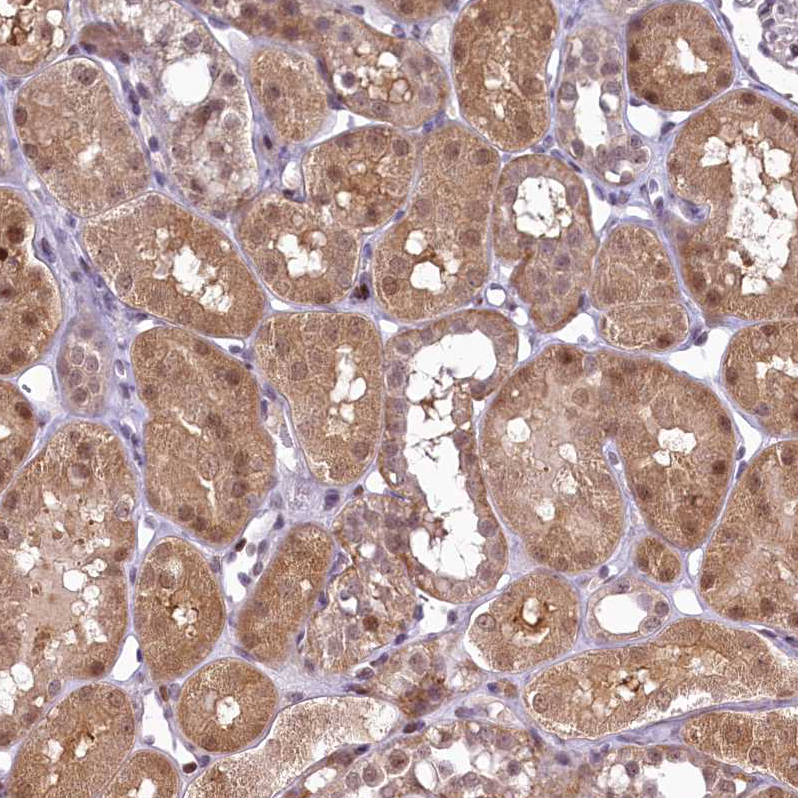 Atlas Antibodies Anti-ANKS3 Antibody