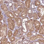 Atlas Antibodies Anti-ANKS3 Antibody