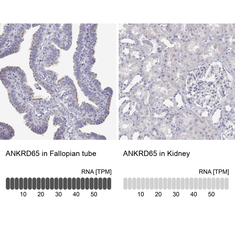 Atlas Antibodies Anti-ANKRD65 Antibody