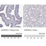 Atlas Antibodies Anti-ANKRD65 Antibody