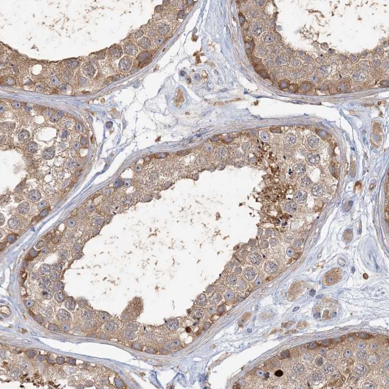 Atlas Antibodies Anti-ANKS1A Antibody