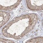 Atlas Antibodies Anti-ANKS1A Antibody