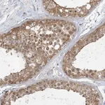 Atlas Antibodies Anti-ANKS1A Antibody