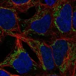 Atlas Antibodies Anti-ANKRD63 Antibody