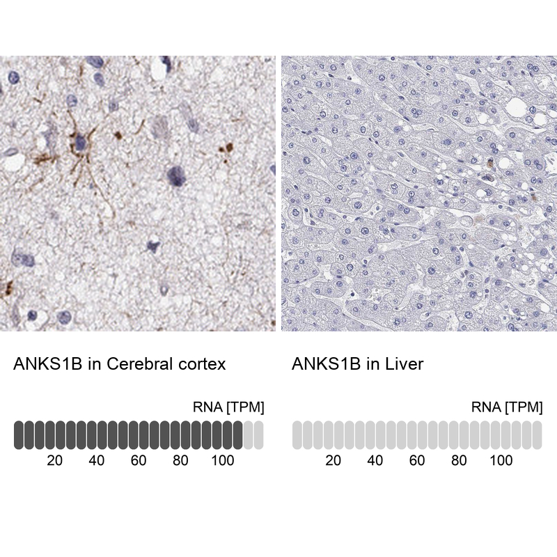 Atlas Antibodies Anti-ANKS1B Antibody