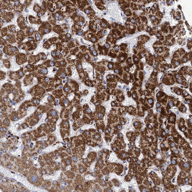 Atlas Antibodies Anti-ANKS3 Antibody