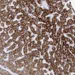 Atlas Antibodies Anti-ANKS3 Antibody